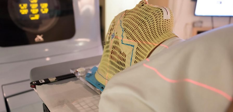 paciente com câncer recebendo tratamento de radioterapia
